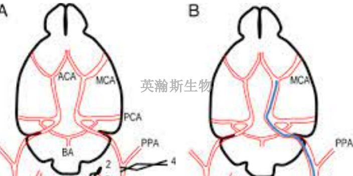 山西小鼠脑缺血再灌注模型构建