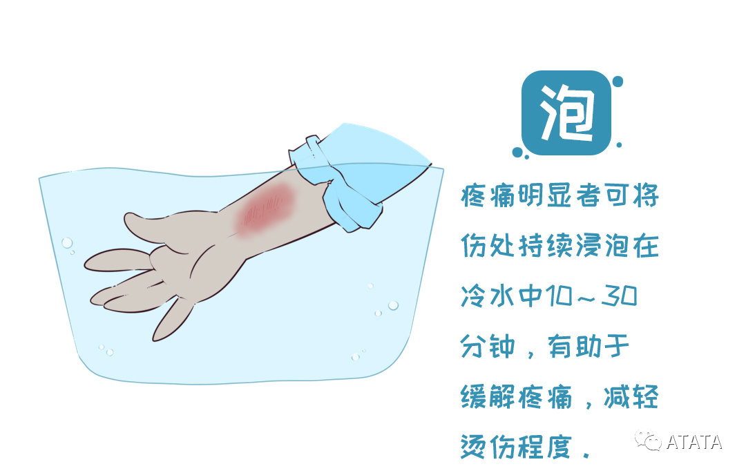 这四类烧伤如何自救?如何在烧伤后进行正确的现场急救?-爱氏(深圳)医药有限公司