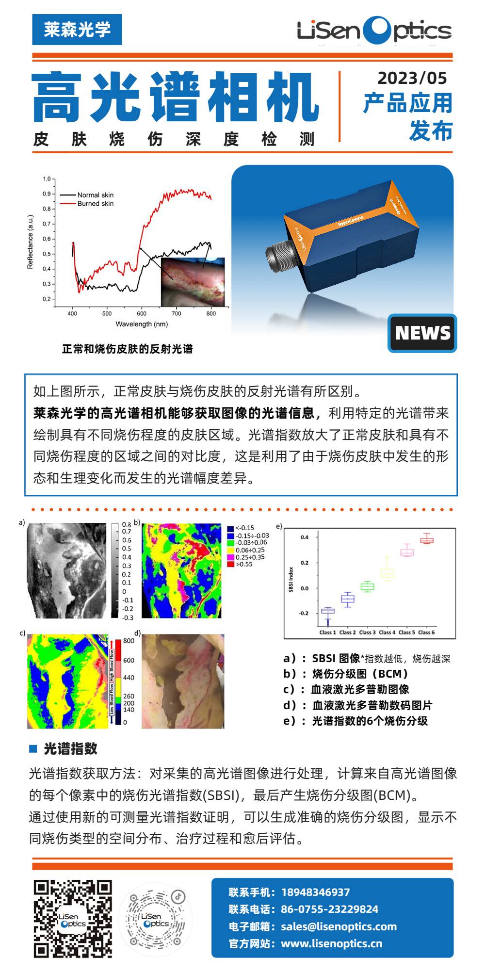 高光譜相機在皮膚燒傷的深度檢測.jpg