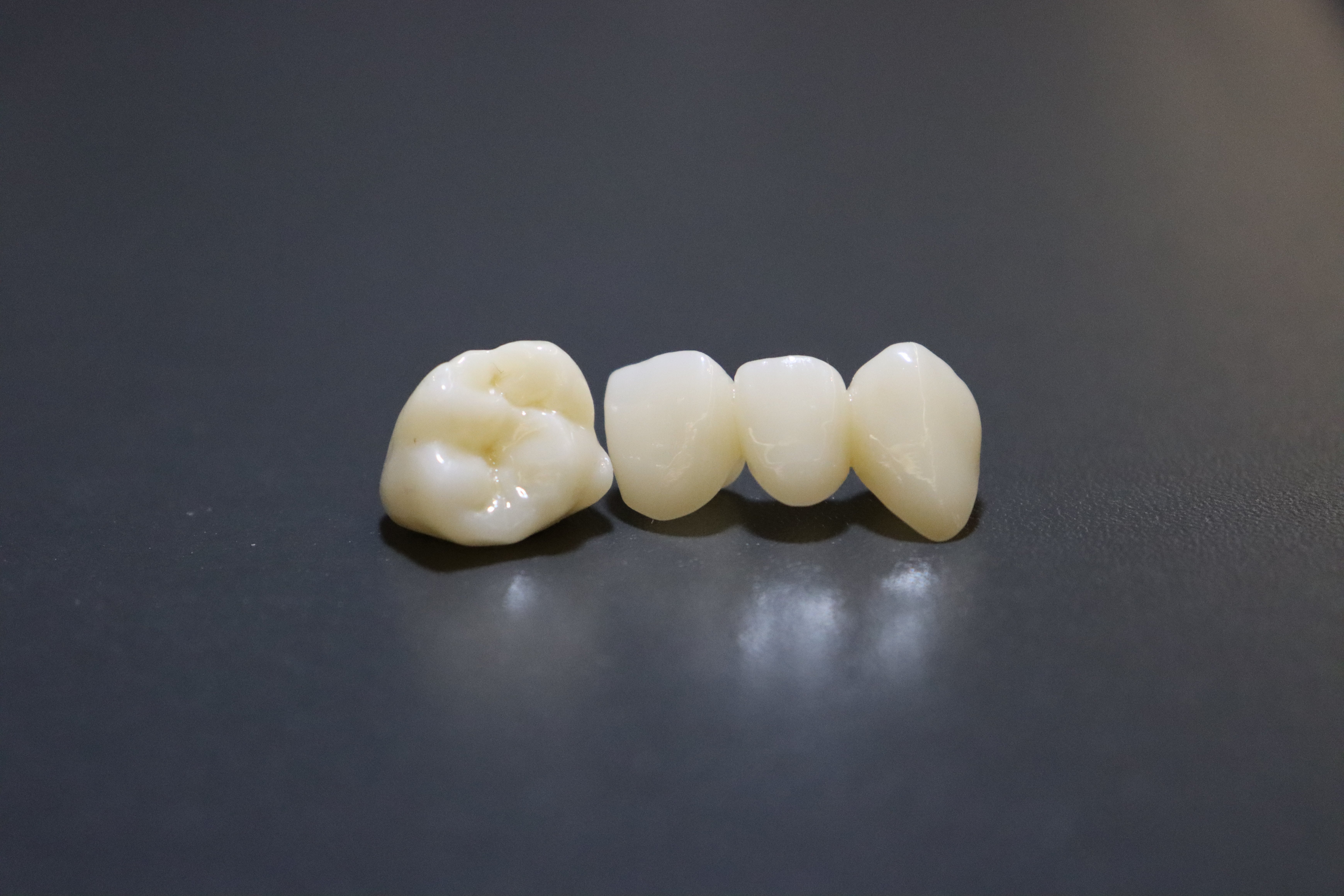 烤瓷牙好还是全瓷牙好呢?推荐新一代瑞典瓷纳米全锆牙!