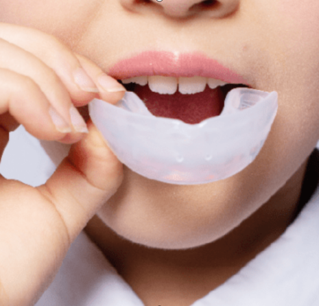 儿童eta肌功能矫正器