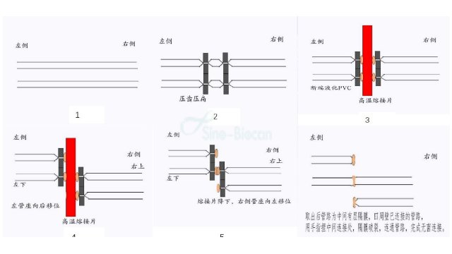 广东血袋无菌接合机器销售厂家