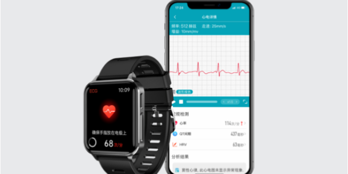 心电手表的数据用于心脏病预防