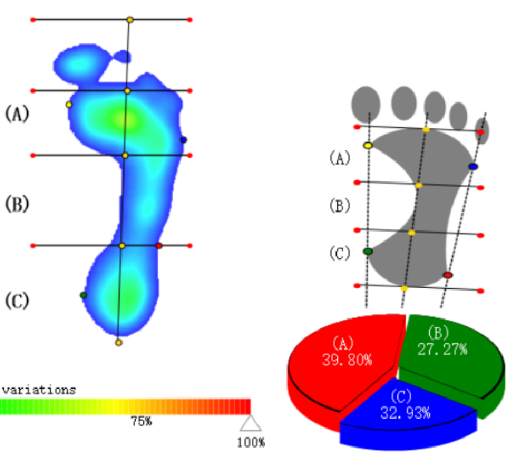 足弓AIF&D分析