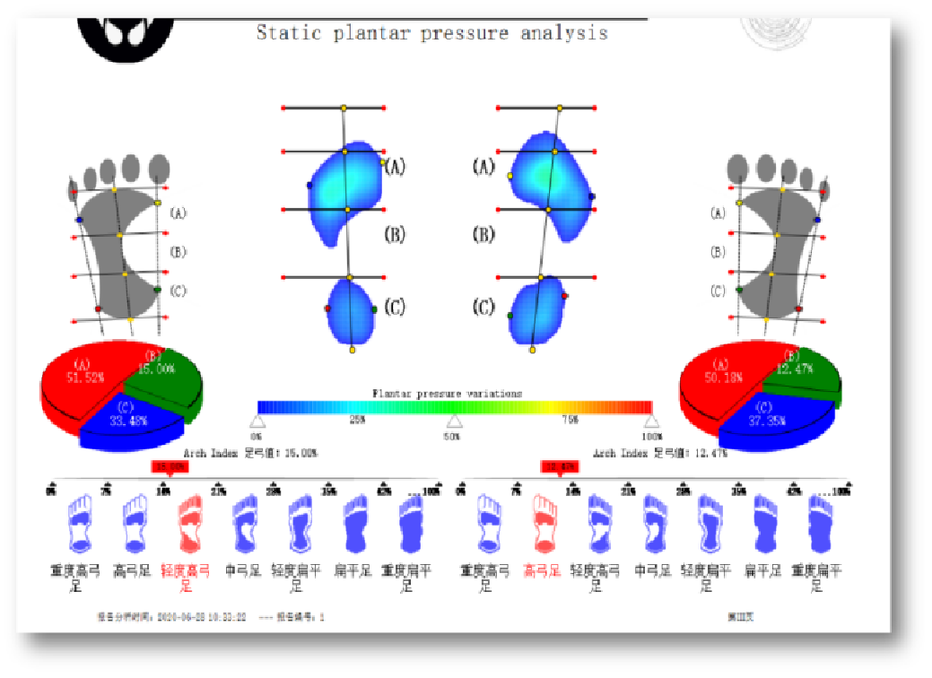 足底壓力數(shù)據(jù)