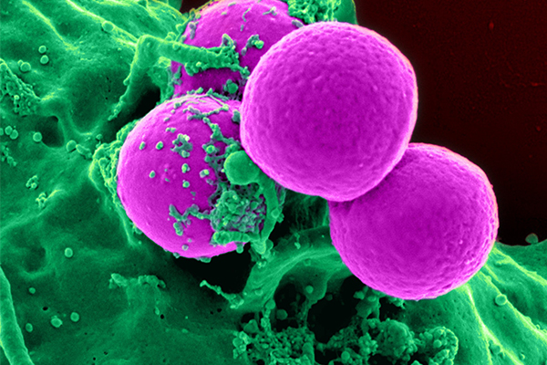 多色免疫熒光技術助力策略優(yōu)化