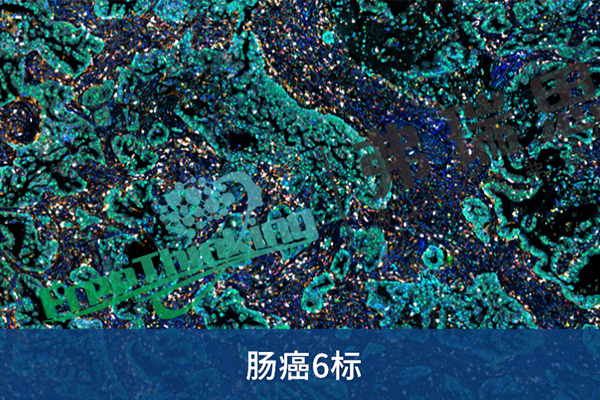 腸癌6標(biāo)