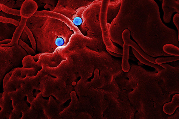 TUNEL染色技術在細胞凋亡研究中的應用