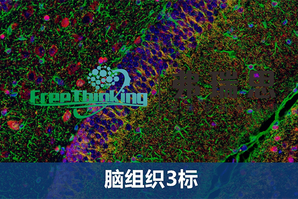 腦組織3標(biāo)