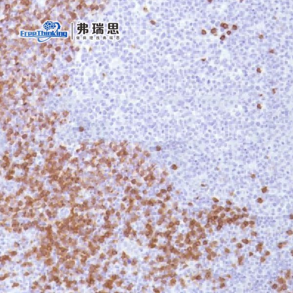 常规病理染色技术服务-病理切片扫描-病理图像分析-南京弗瑞思生物科技有限公司