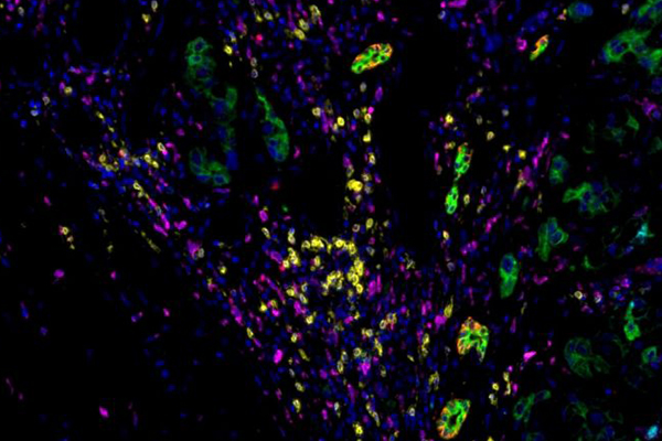 春季培訓(xùn)班 | 多色熒光免疫組化全景解析