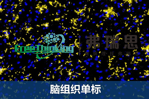 腦組織單標(biāo)