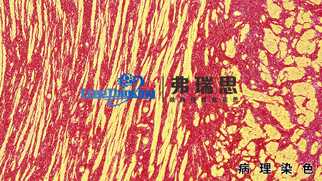 杭州組織芯片病理染色分析 南京弗瑞思生物科技供應(yīng)