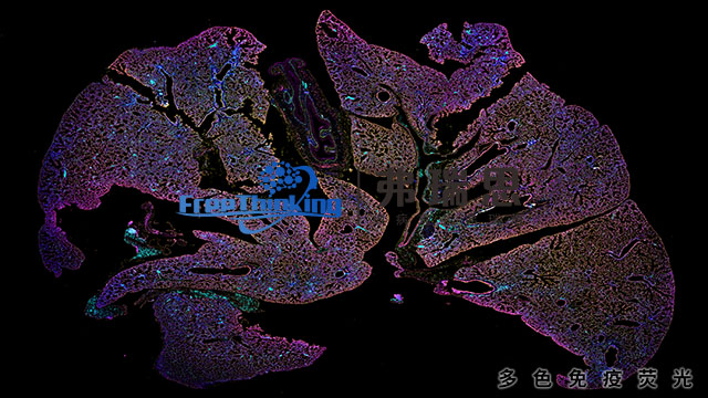 连云港切片多色免疫荧光TAS技术原理 南京弗瑞思生物科技供应