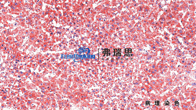 惠州组织芯片病理染色扫描,病理染色