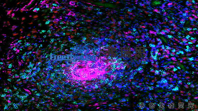 泰州病理多色免疫荧光原理 南京弗瑞思生物科技供应