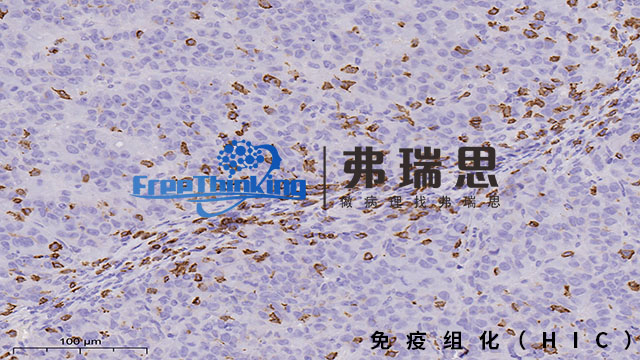 淮安免疫组化分析