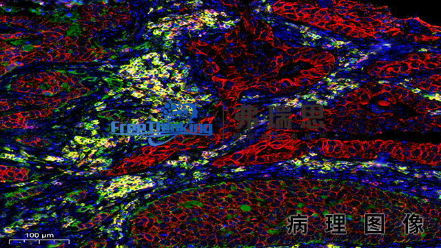 宿迁切片病理图像染色 南京弗瑞思生物科技供应