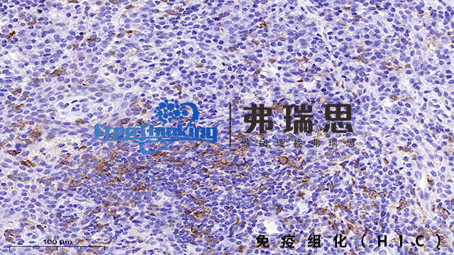 肇庆组织芯片免疫组化 南京弗瑞思生物科技供应