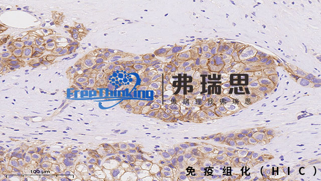 宁波组织芯片免疫组化扫描 南京弗瑞思生物科技供应
