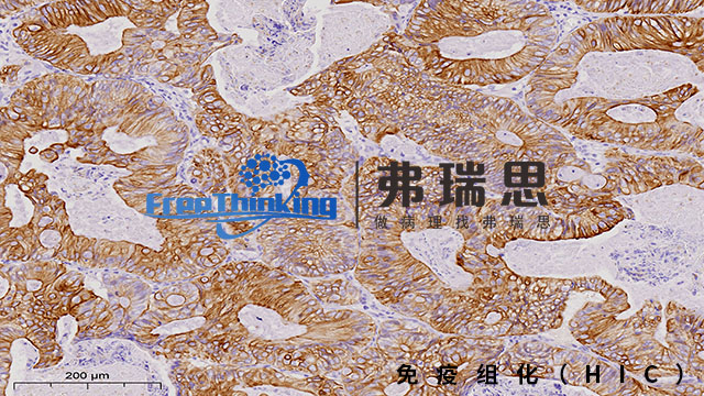惠州病理切片免疫组化实验流程 南京弗瑞思生物科技供应