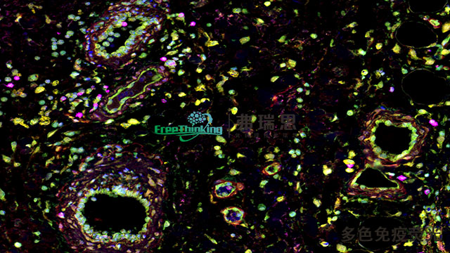 上海TME多色免疫荧光实验流程,多色免疫荧光