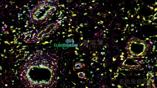 揭阳切片多色免疫荧光染色 南京弗瑞思生物科技供应