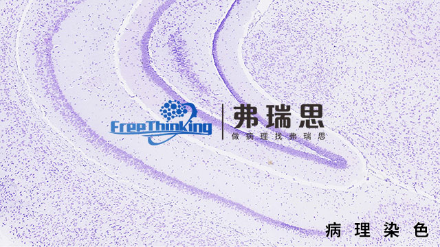 茂名多色免疫荧光病理染色原理 南京弗瑞思生物科技供应