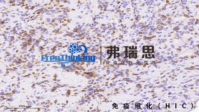 衢州组织芯片免疫组化分析,免疫组化