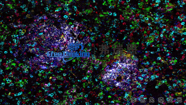 衢州TME多色免疫荧光扫描 南京弗瑞思生物科技供应