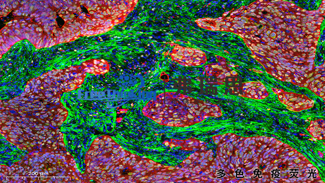 湛江切片多色免疫荧光原理 南京弗瑞思生物科技供应