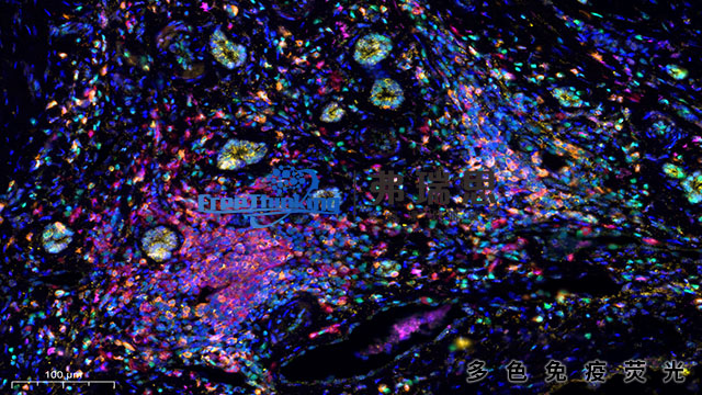 河源切片多色免疫荧光扫描 南京弗瑞思生物科技供应