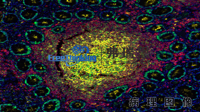 江苏多色免疫荧光病理图像实验流程 南京弗瑞思生物科技供应