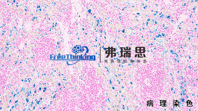 惠州组织芯片病理染色扫描,病理染色