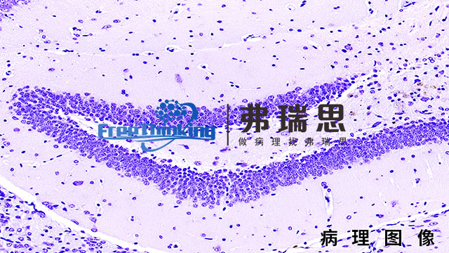 南京油红O病理图像 南京弗瑞思生物科技供应