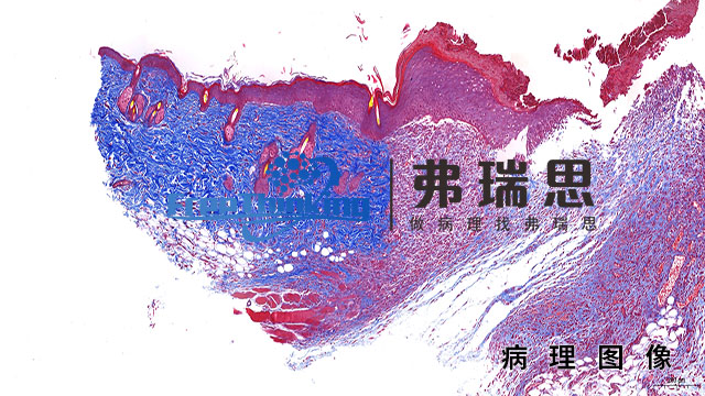 上海油红O病理图像原理,病理图像