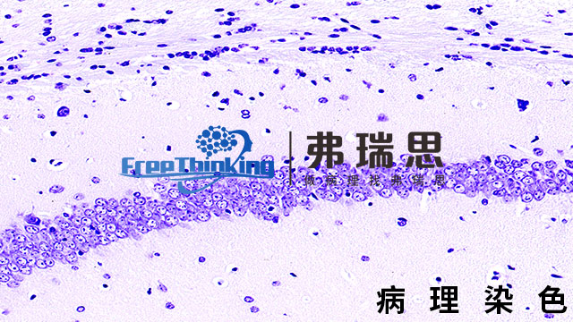 韶关多色免疫荧光病理染色实验流程 南京弗瑞思生物科技供应