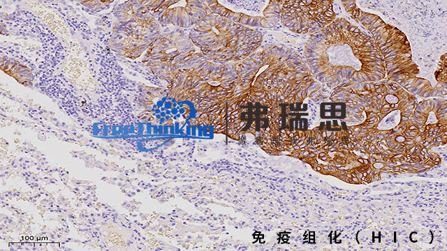深圳组织芯片免疫组化扫描 南京弗瑞思生物科技供应