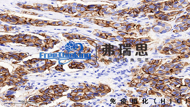 衢州组织芯片免疫组化分析,免疫组化