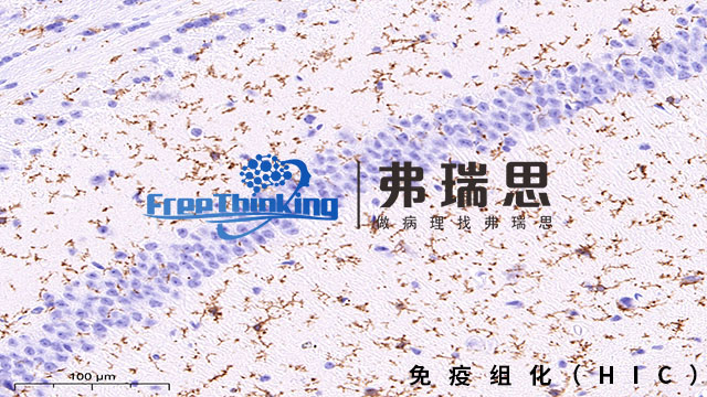 泰州病理切片免疫组化原理 南京弗瑞思生物科技供应