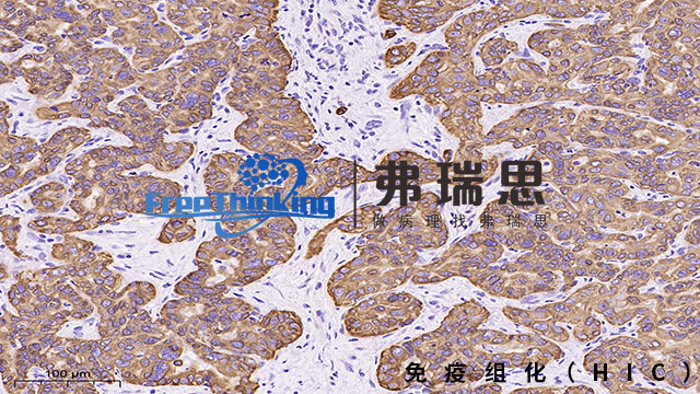 深圳病理切片免疫组化分析,免疫组化