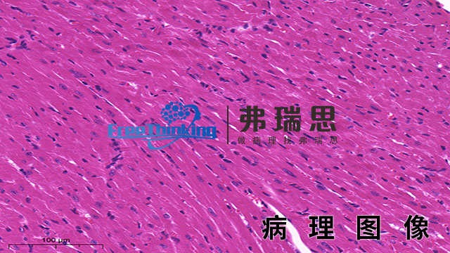 舟山HE染色病理图像分析 南京弗瑞思生物科技供应