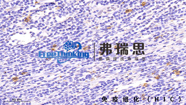 深圳病理切片免疫组化分析,免疫组化