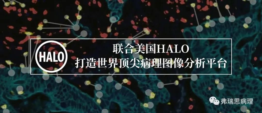 HALO病理圖像分析在免疫病理中的應(yīng)用
