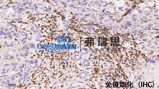 淮安多重免疫组化实验流程 南京弗瑞思生物科技供应