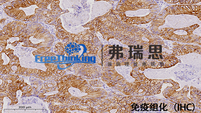 组织芯片免疫组化分析 南京弗瑞思生物科技供应