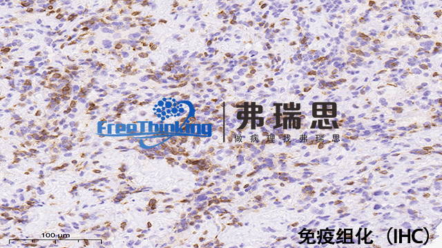 珠海多重免疫组化 南京弗瑞思生物科技供应