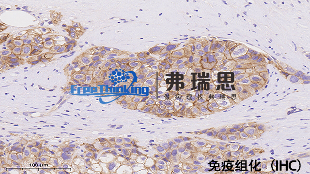 宁波病理切片免疫组化价格 南京弗瑞思生物科技供应