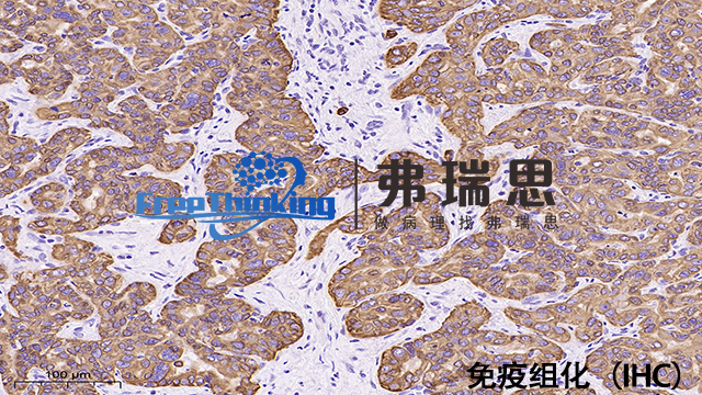宁波病理切片免疫组化分析 南京弗瑞思生物科技供应