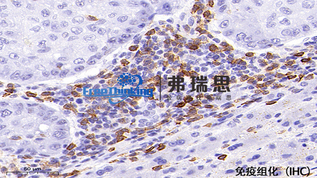 嘉兴组织芯片免疫组化分析